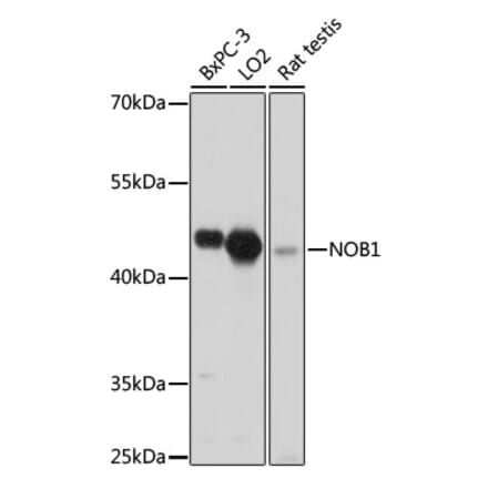 Western Blot - Anti-NOB1 Antibody (A90093) - Antibodies.com