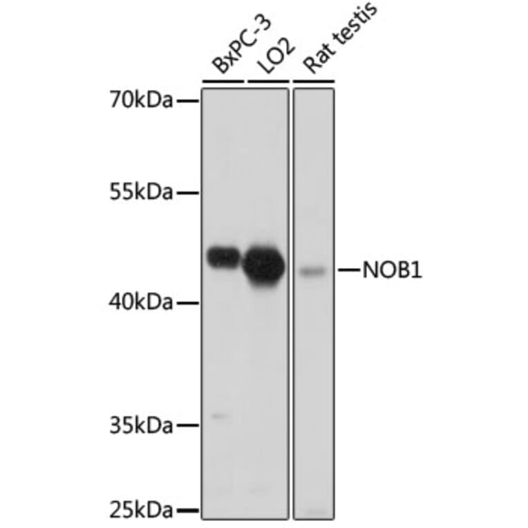 Western Blot - Anti-NOB1 Antibody (A90093) - Antibodies.com