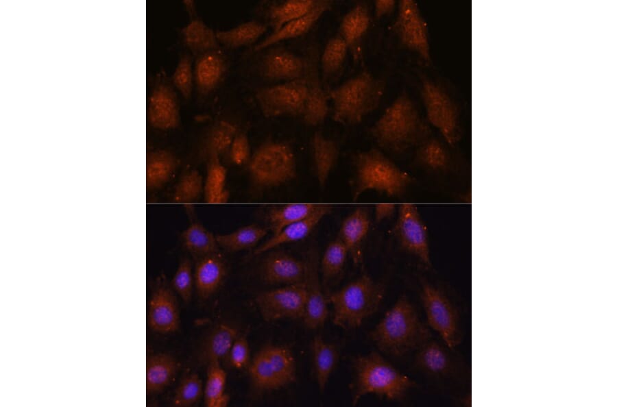Immunofluorescence - Anti-NOB1 Antibody (A90093) - Antibodies.com