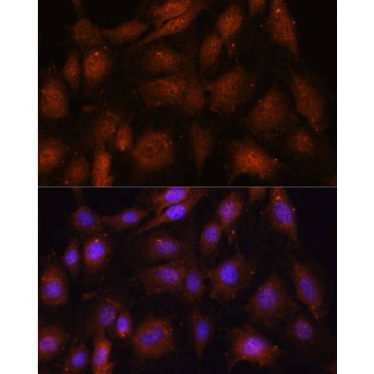 Immunofluorescence - Anti-NOB1 Antibody (A90093) - Antibodies.com