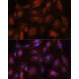 Immunofluorescence - Anti-NOB1 Antibody (A90093) - Antibodies.com