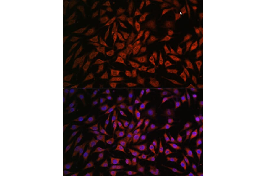 Immunofluorescence - Anti-NOB1 Antibody (A90093) - Antibodies.com