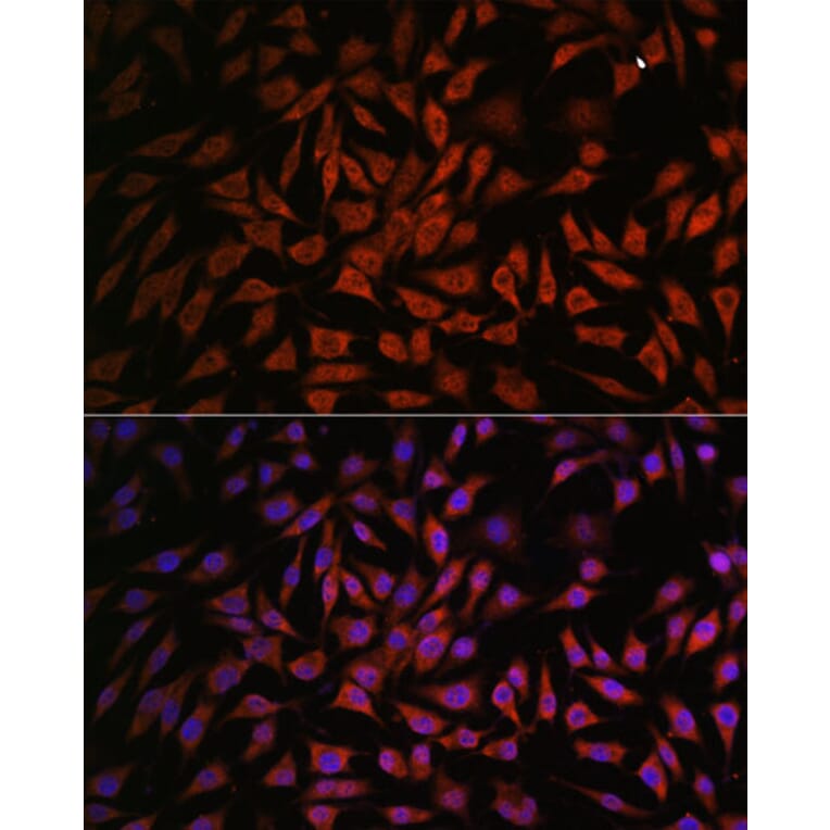Immunofluorescence - Anti-NOB1 Antibody (A90093) - Antibodies.com