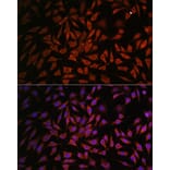 Immunofluorescence - Anti-NOB1 Antibody (A90093) - Antibodies.com