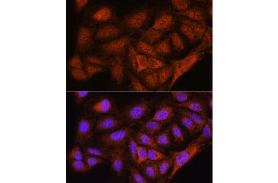 Immunofluorescence - Anti-NOB1 Antibody (A90093) - Antibodies.com