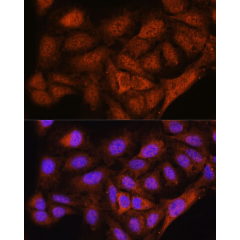 Immunofluorescence - Anti-NOB1 Antibody (A90093) - Antibodies.com