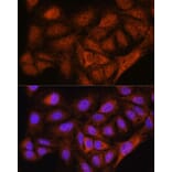 Immunofluorescence - Anti-NOB1 Antibody (A90093) - Antibodies.com