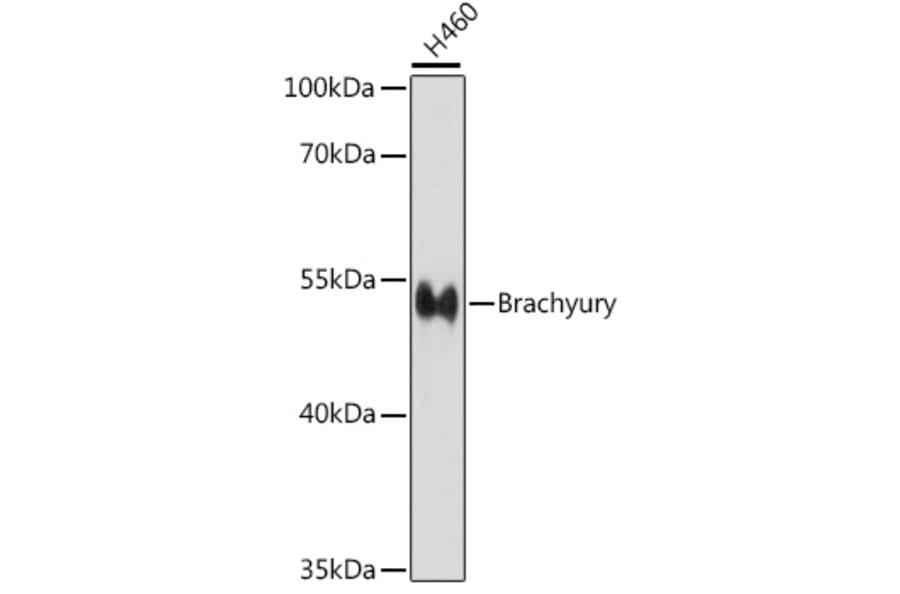 Western Blot - Anti-Brachyury/Bry Antibody (A90095) - Antibodies.com