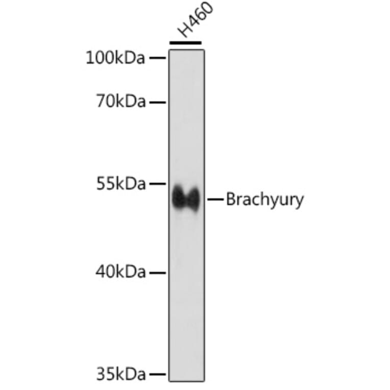 Western Blot - Anti-Brachyury/Bry Antibody (A90095) - Antibodies.com