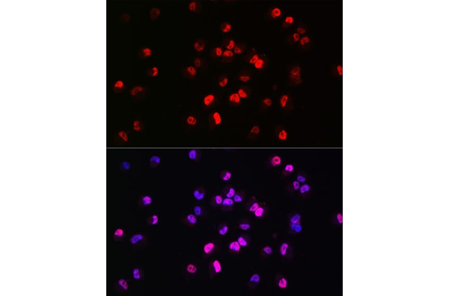 Immunofluorescence - Anti-Brachyury/Bry Antibody (A90095) - Antibodies.com