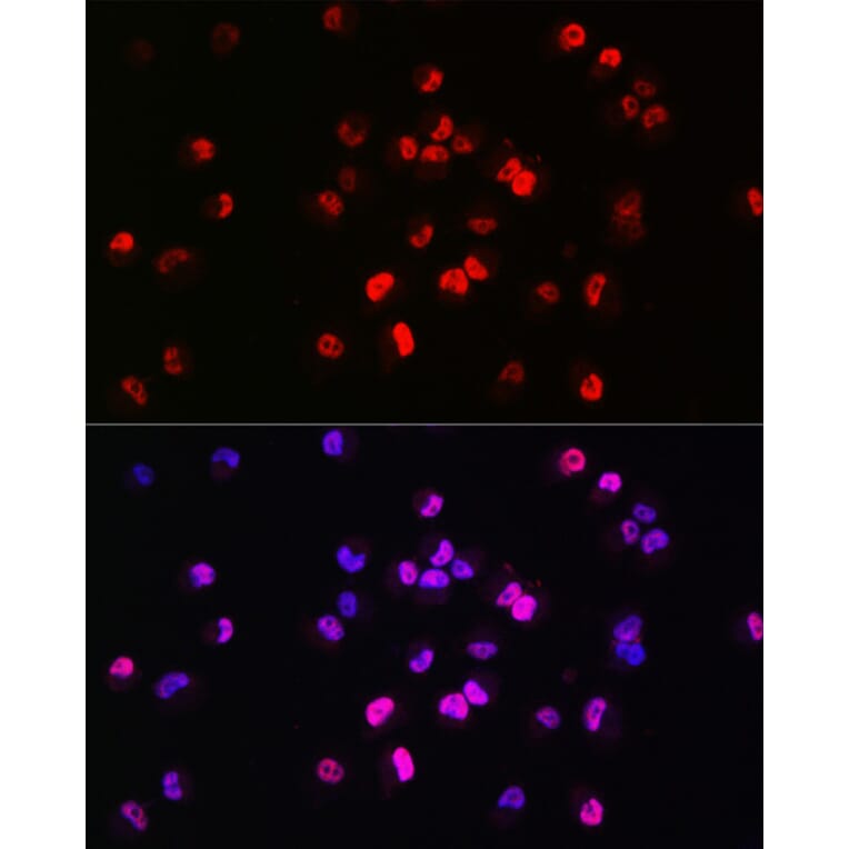 Immunofluorescence - Anti-Brachyury/Bry Antibody (A90095) - Antibodies.com