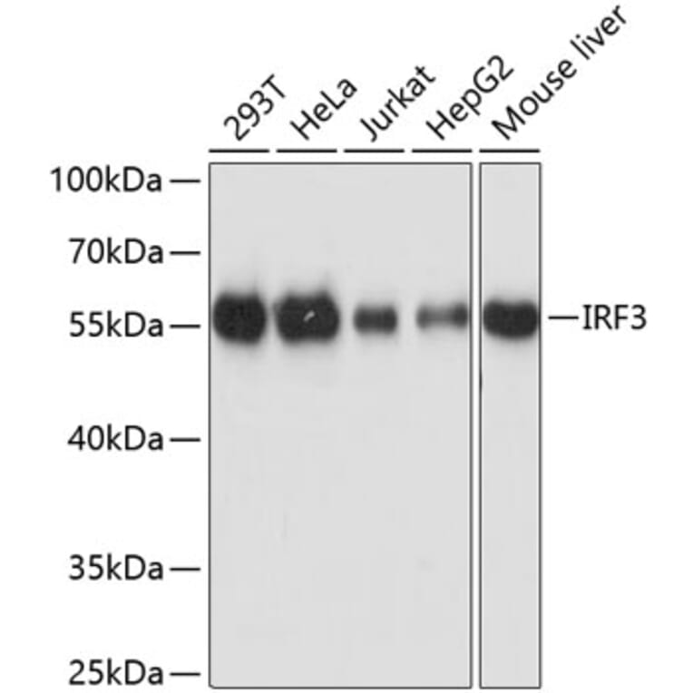 Western Blot - Anti-IRF3 Antibody (A0816) - Antibodies.com