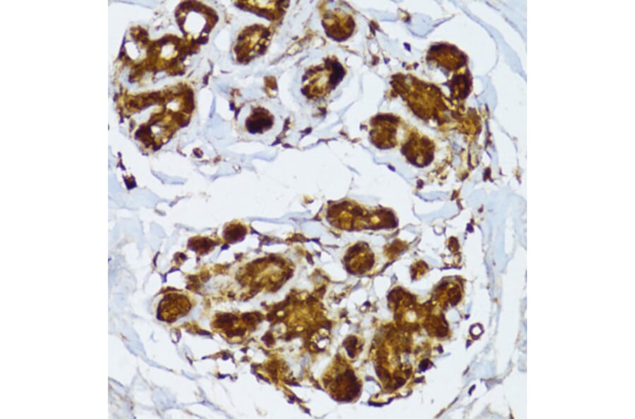 Immunohistochemistry - Anti-IRF3 Antibody (A0816) - Antibodies.com