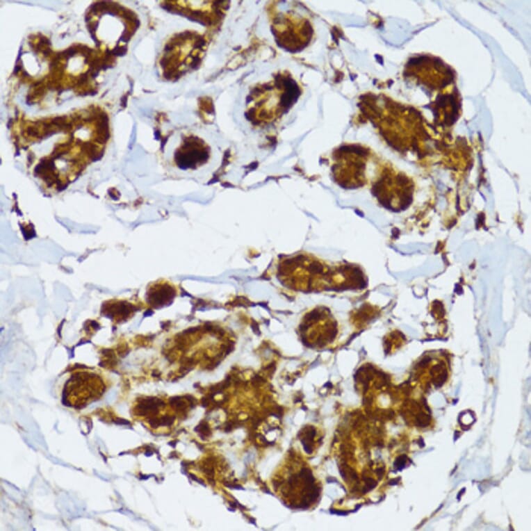 Immunohistochemistry - Anti-IRF3 Antibody (A0816) - Antibodies.com