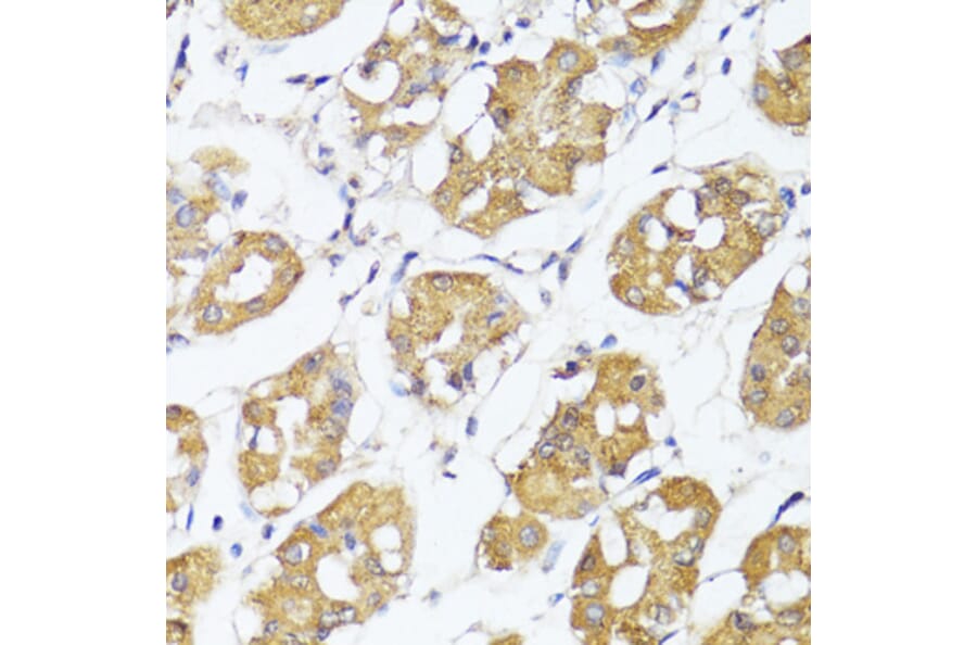 Immunohistochemistry - Anti-IRF3 Antibody (A0816) - Antibodies.com