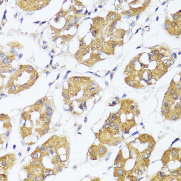 Immunohistochemistry - Anti-IRF3 Antibody (A0816) - Antibodies.com