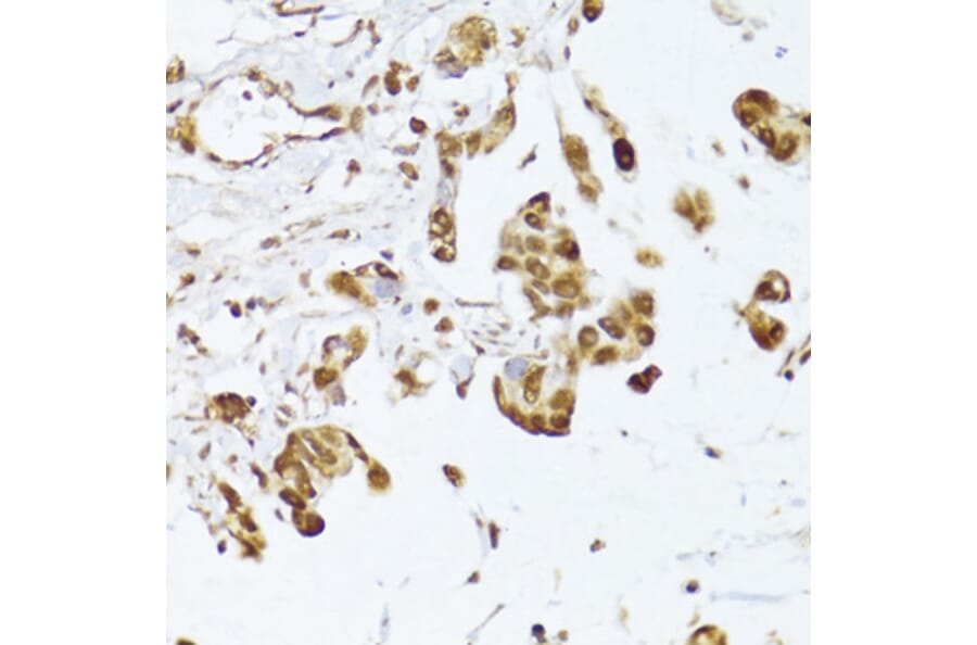 Immunohistochemistry - Anti-IRF3 Antibody (A0816) - Antibodies.com