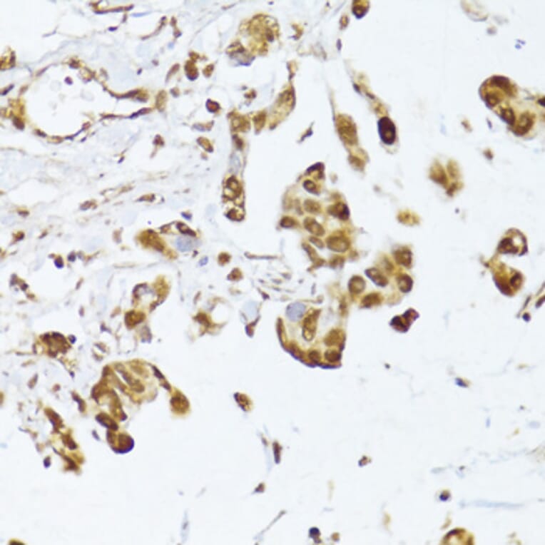 Immunohistochemistry - Anti-IRF3 Antibody (A0816) - Antibodies.com