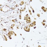 Immunohistochemistry - Anti-IRF3 Antibody (A0816) - Antibodies.com