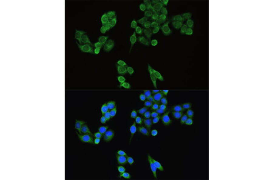 Immunofluorescence - Anti-IRF3 Antibody (A0816) - Antibodies.com