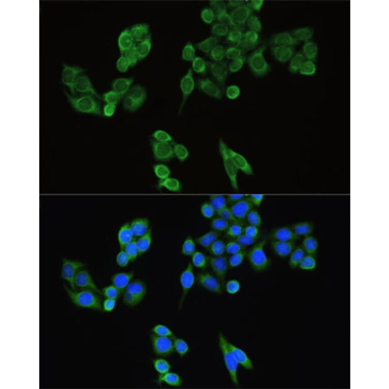 Immunofluorescence - Anti-IRF3 Antibody (A0816) - Antibodies.com