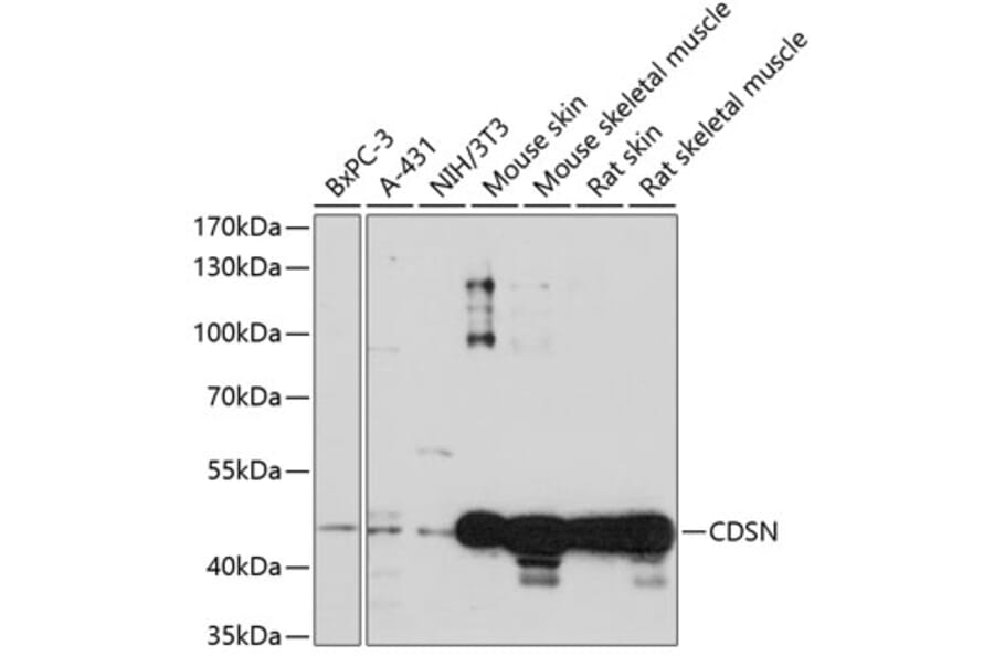 Western Blot - Anti-Corneodesmosin/S protein Antibody (A90097) - Antibodies.com