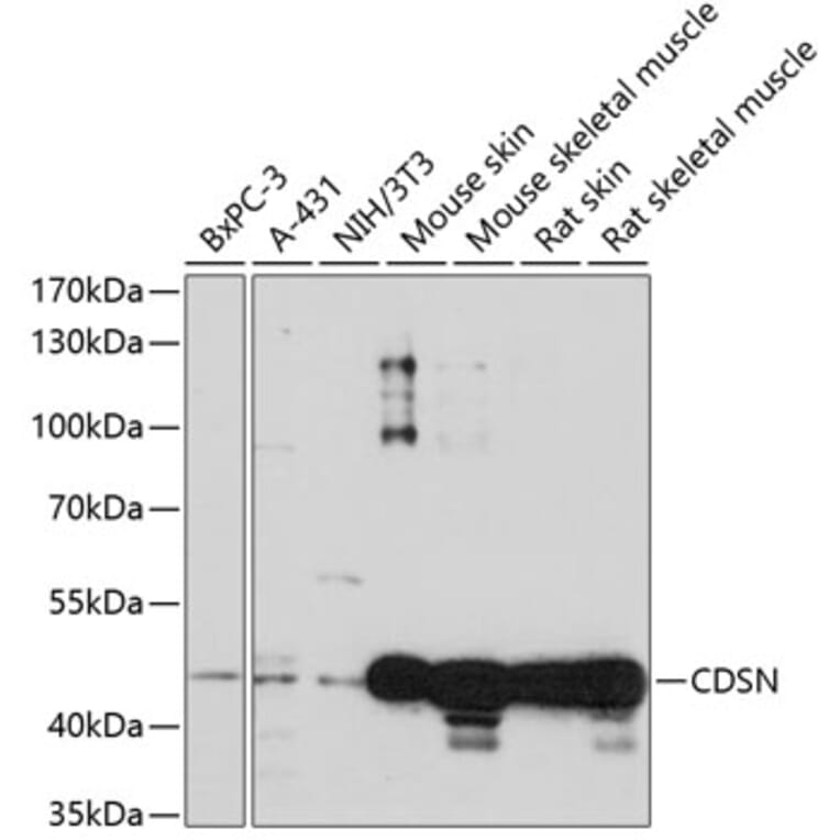 Western Blot - Anti-Corneodesmosin/S protein Antibody (A90097) - Antibodies.com