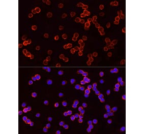 Immunofluorescence - Anti-TSG101 Antibody (A90098) - Antibodies.com