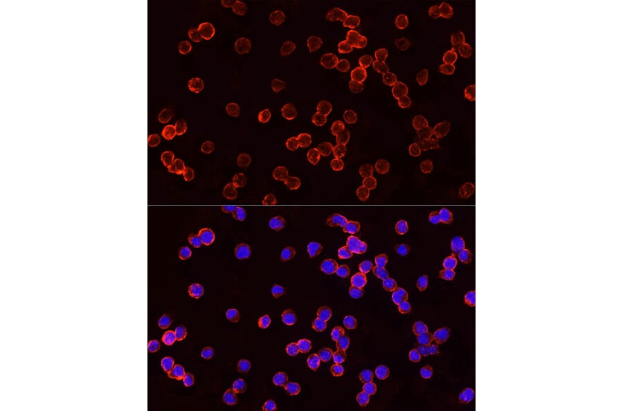 Immunofluorescence - Anti-TSG101 Antibody (A90098) - Antibodies.com