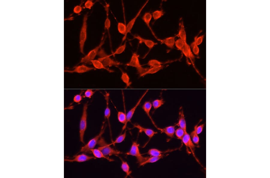Immunofluorescence - Anti-TSG101 Antibody (A90098) - Antibodies.com
