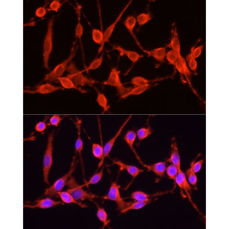 Immunofluorescence - Anti-TSG101 Antibody (A90098) - Antibodies.com