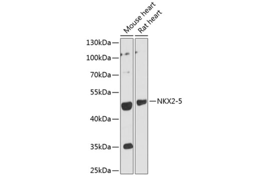 Western Blot - Anti-NKX2-5 Antibody (A12688) - Antibodies.com