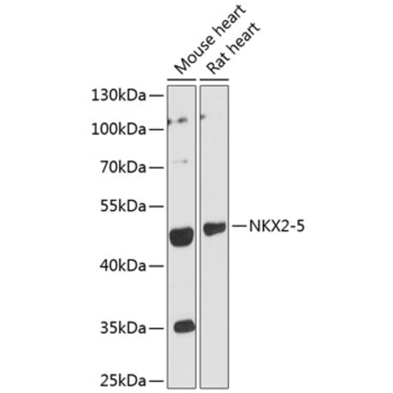 Western Blot - Anti-NKX2-5 Antibody (A12688) - Antibodies.com