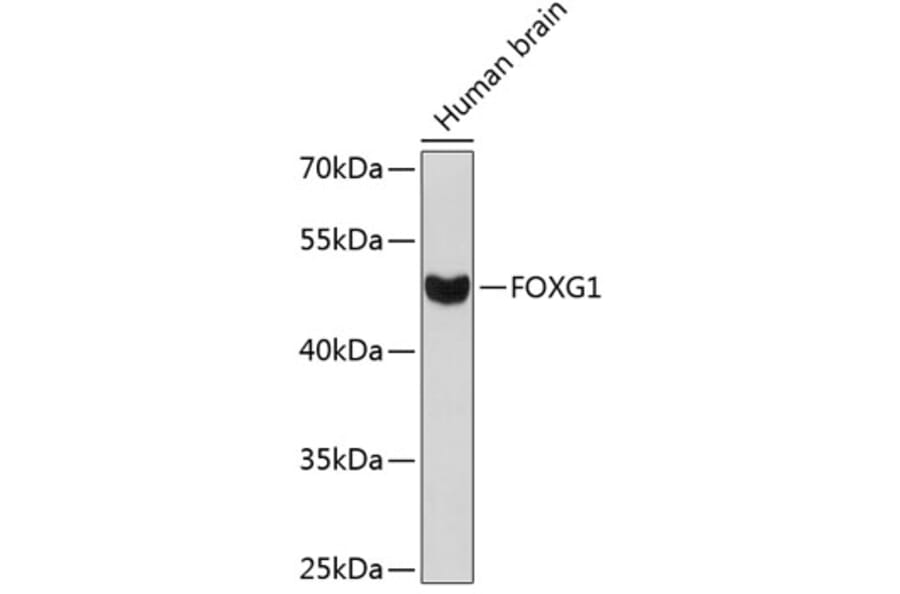 Western Blot - Anti-FOXG1 Antibody (A12389) - Antibodies.com