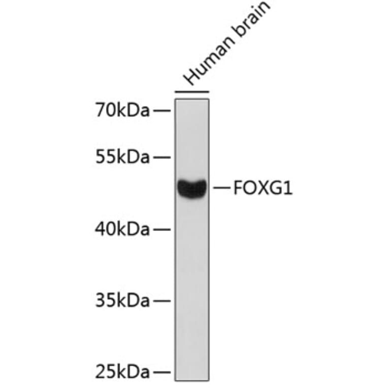 Western Blot - Anti-FOXG1 Antibody (A12389) - Antibodies.com