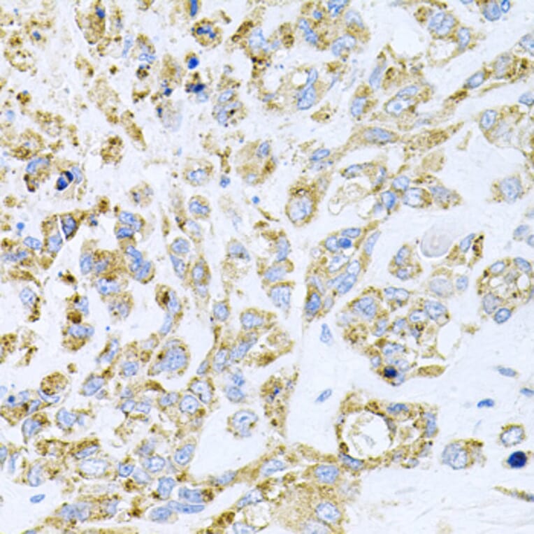 Immunohistochemistry - Anti-HDAC3 Antibody (A90101) - Antibodies.com