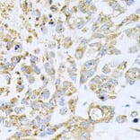 Immunohistochemistry - Anti-HDAC3 Antibody (A90101) - Antibodies.com
