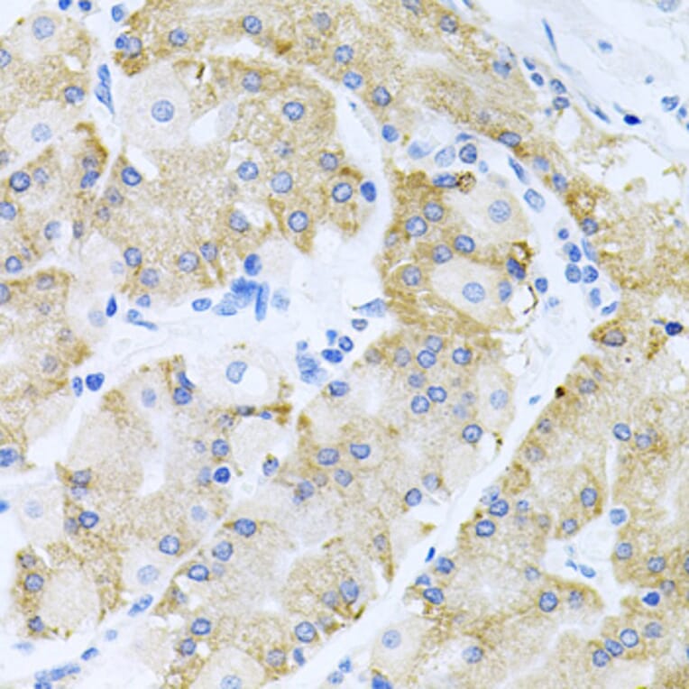 Immunohistochemistry - Anti-HDAC3 Antibody (A90101) - Antibodies.com