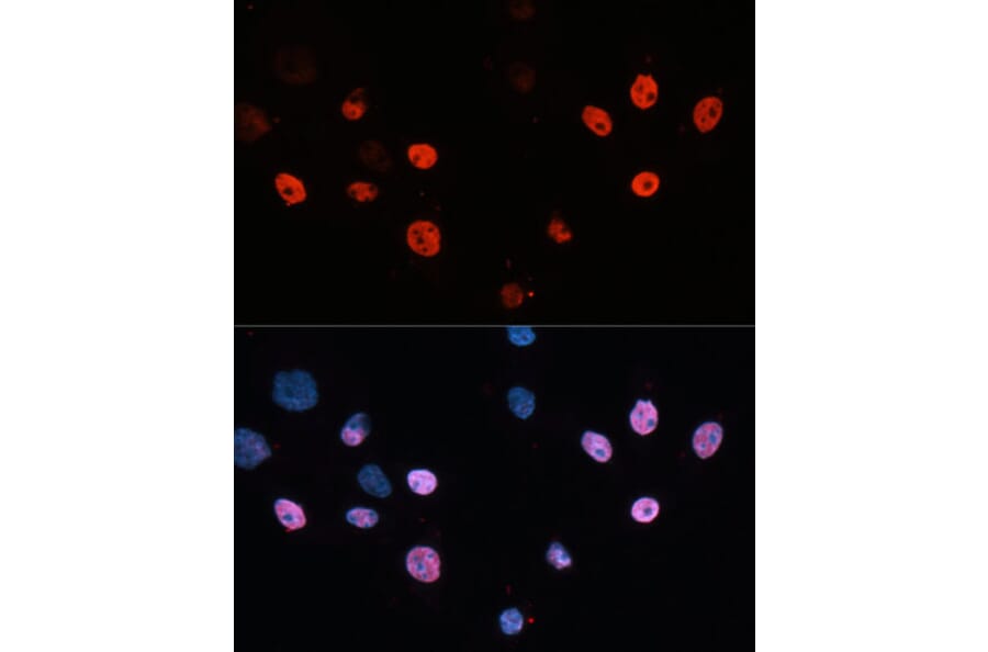 Immunofluorescence - Anti-HDAC3 Antibody (A90101) - Antibodies.com
