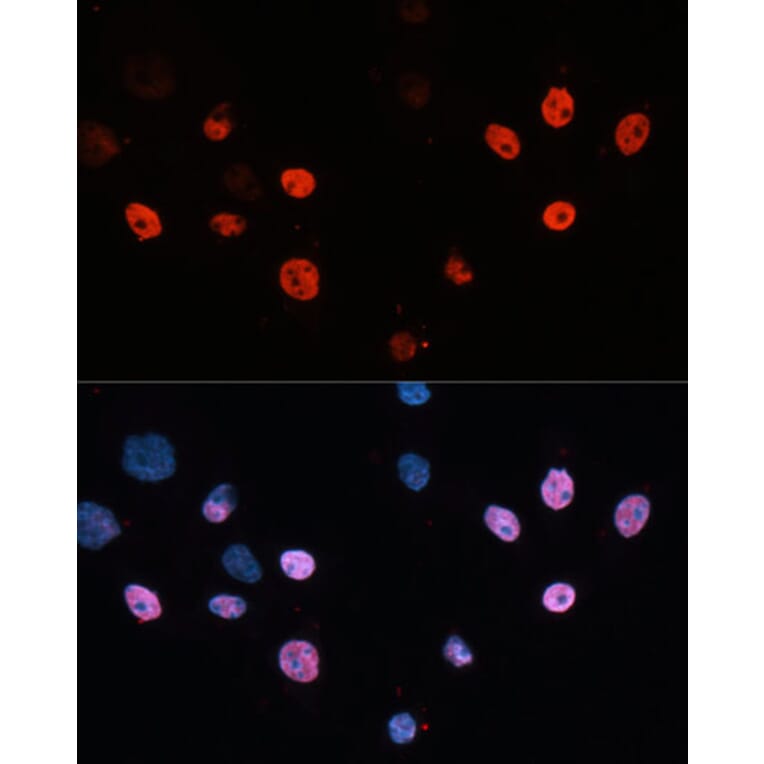 Immunofluorescence - Anti-HDAC3 Antibody (A90101) - Antibodies.com