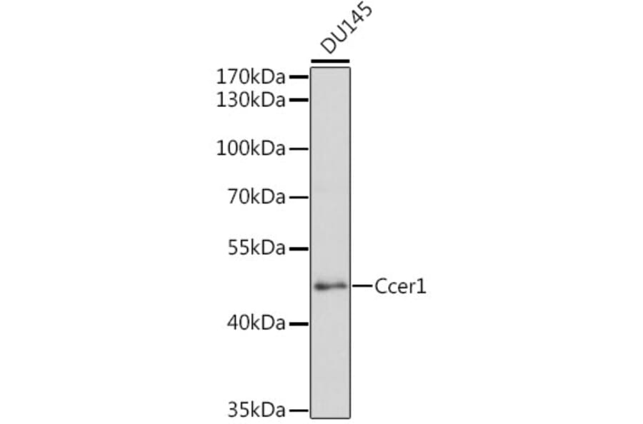 Western Blot - Anti-Ccer1 Antibody (A16606) - Antibodies.com