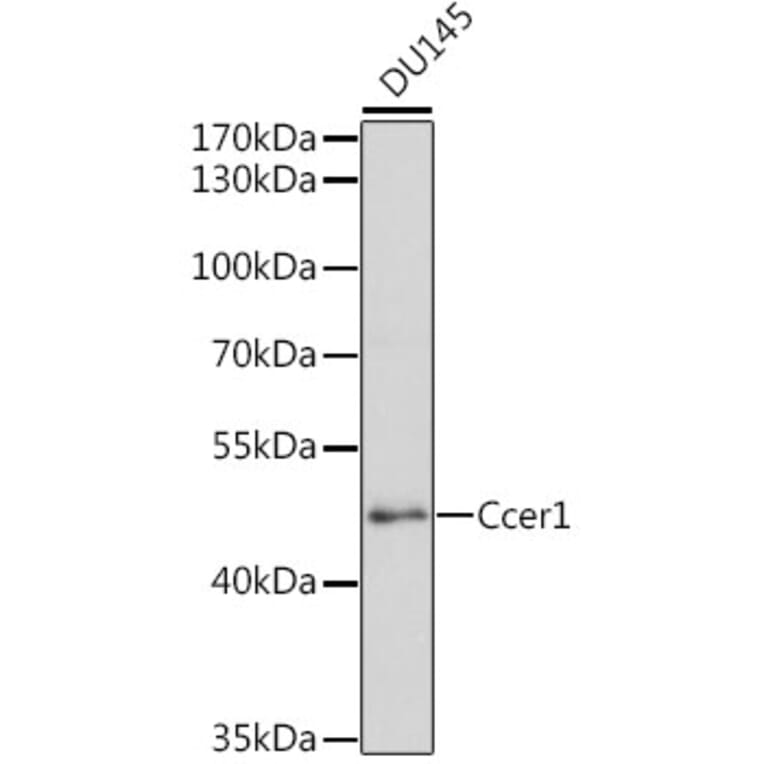 Western Blot - Anti-Ccer1 Antibody (A16606) - Antibodies.com