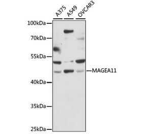 Western Blot - Anti-MAGEA11 Antibody (A90103) - Antibodies.com