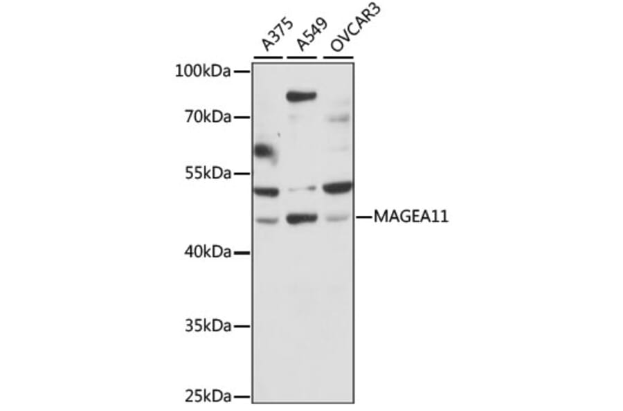 Western Blot - Anti-MAGEA11 Antibody (A90103) - Antibodies.com