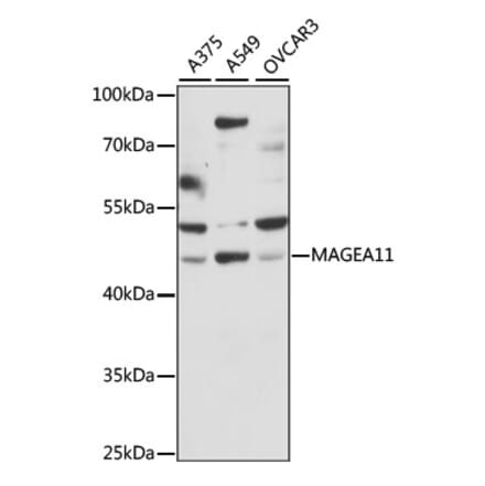 Western Blot - Anti-MAGEA11 Antibody (A90103) - Antibodies.com