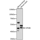 Western Blot - Anti-VPS4B/MIG1 Antibody (A90104) - Antibodies.com