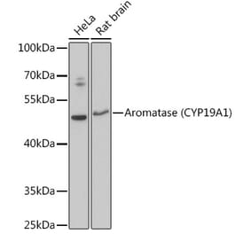 Western Blot - Anti-Aromatase Antibody (A90105) - Antibodies.com
