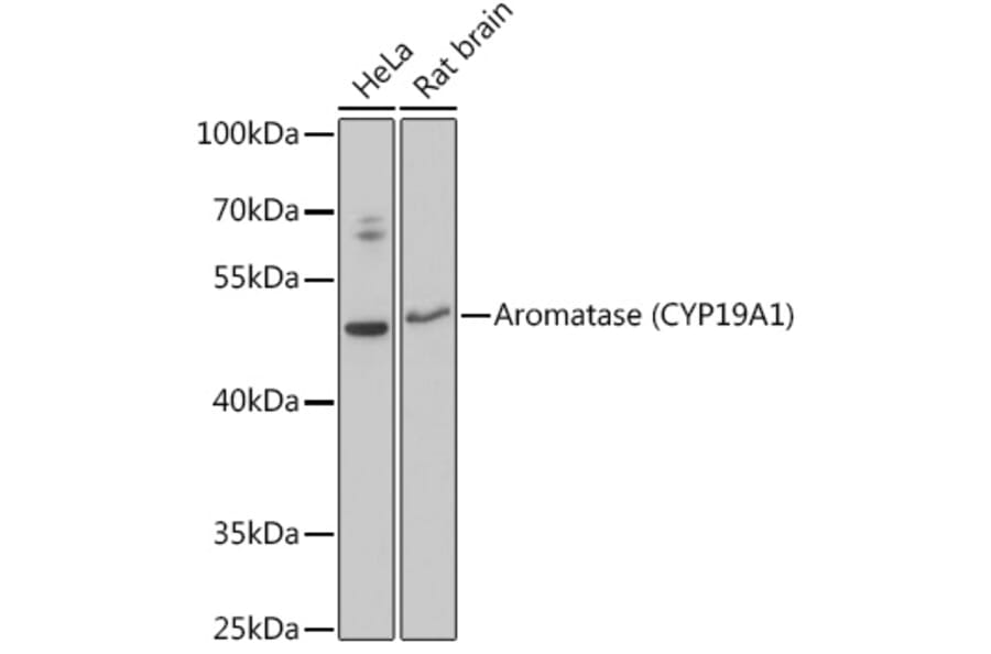 Western Blot - Anti-Aromatase Antibody (A90105) - Antibodies.com