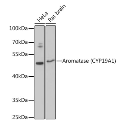 Western Blot - Anti-Aromatase Antibody (A90105) - Antibodies.com