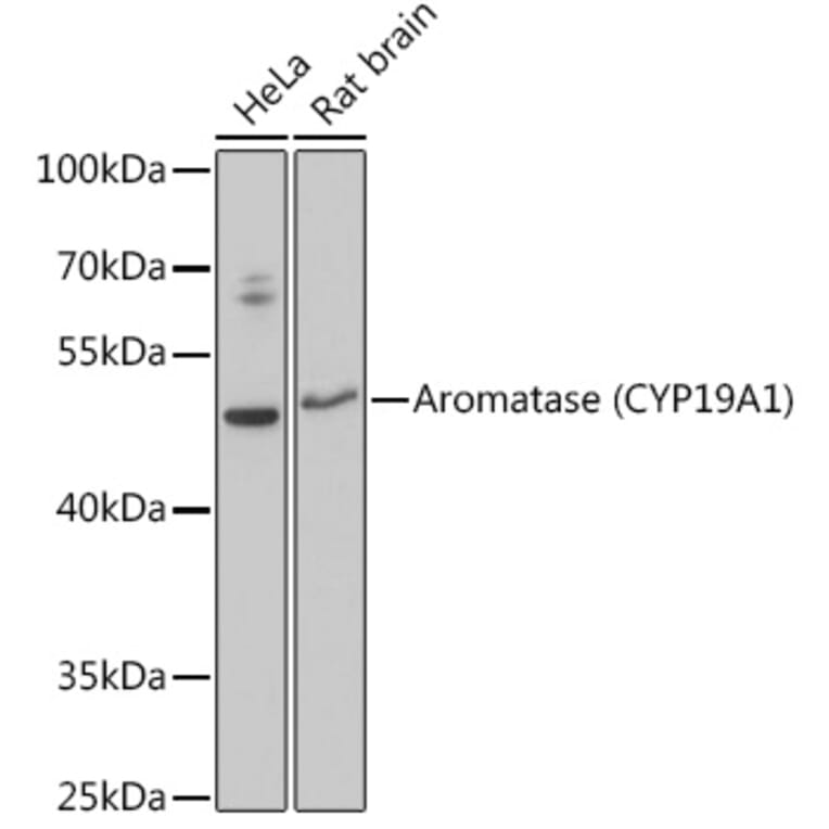 Western Blot - Anti-Aromatase Antibody (A90105) - Antibodies.com